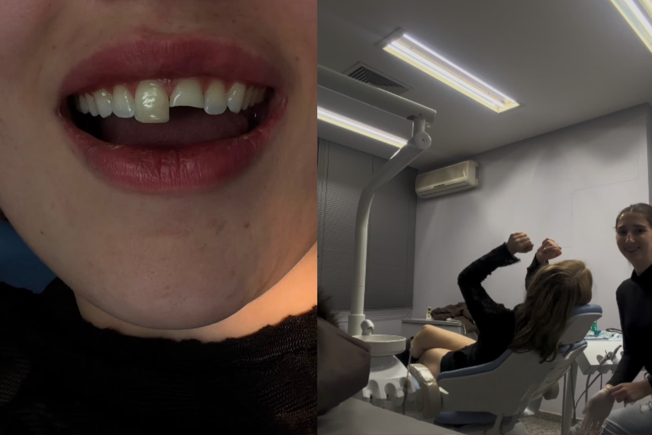 Dentista de madrugada: mulher quebra dente em festa de Foz do Iguaçu e volta para balada